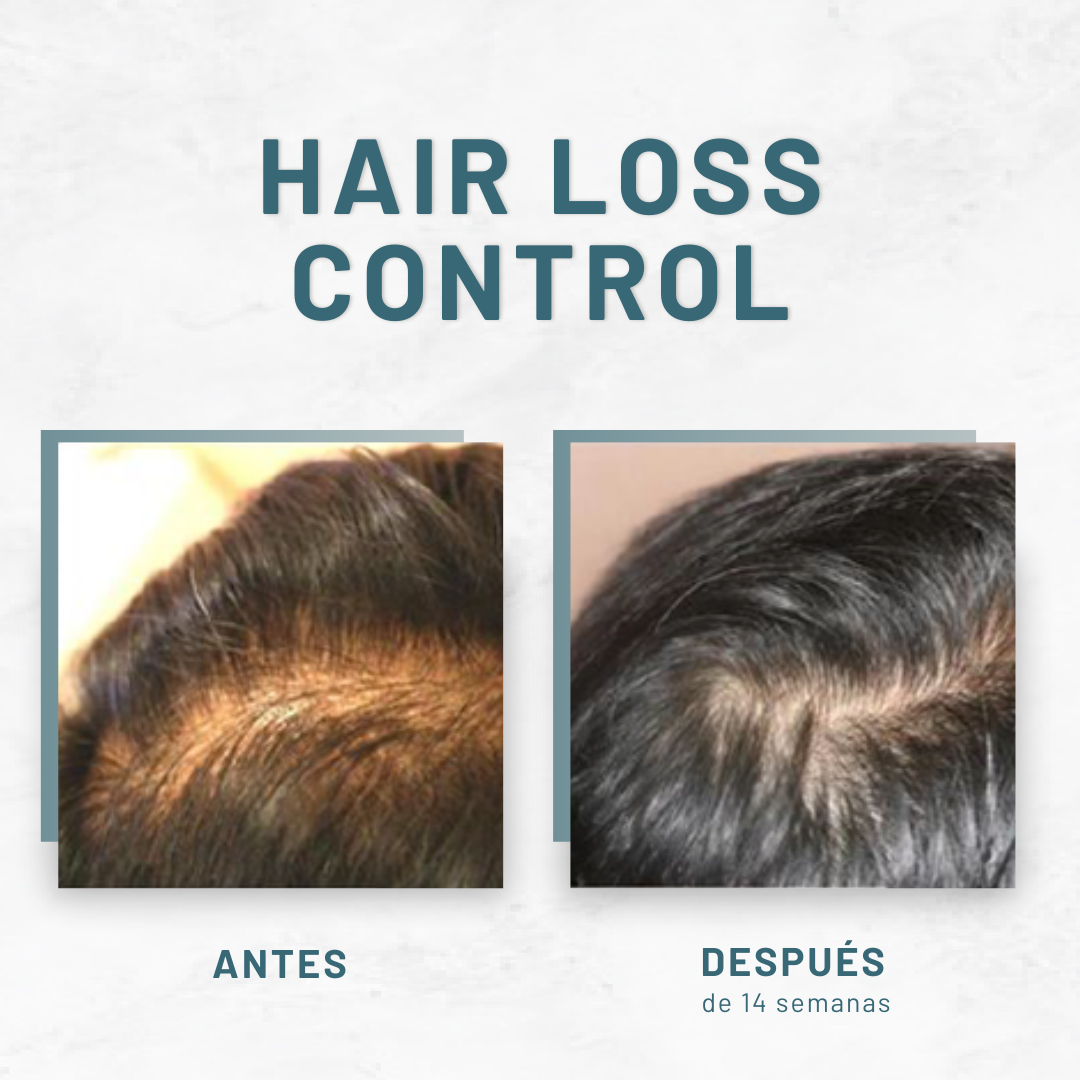 HAIR REVIVAL™ | RECUPERACIÓN CAPILAR AVANZADA