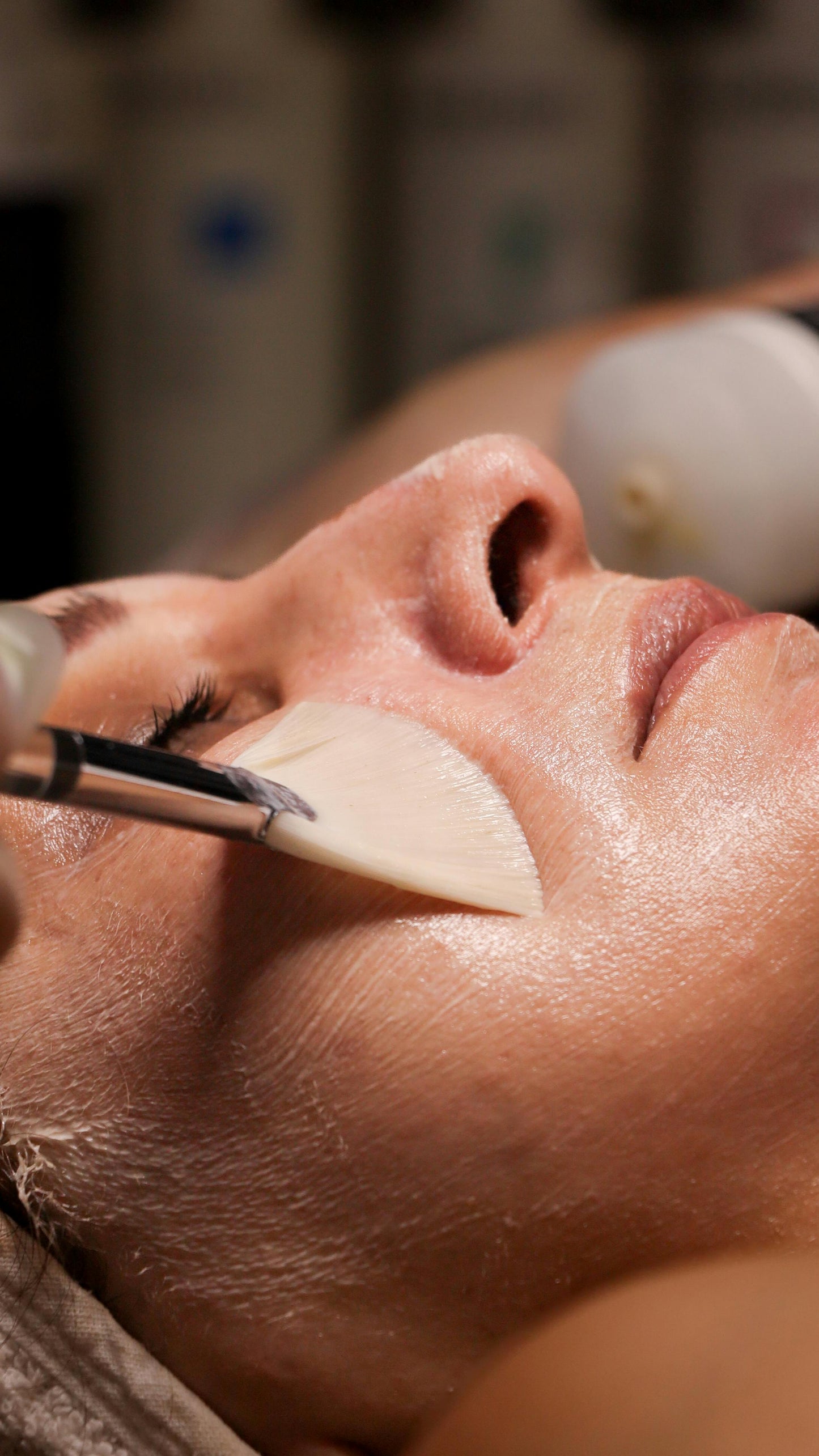HOLLYWOOD PEELING PACK 3 SESIONES